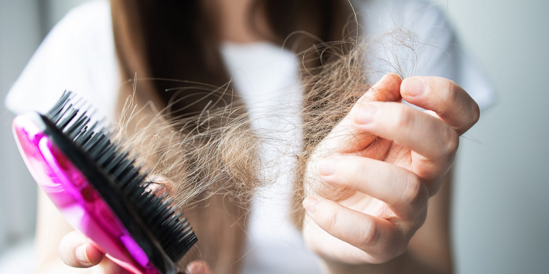 DIY Home Remedies for Hair Fall