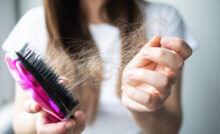 DIY Home Remedies for Hair Fall